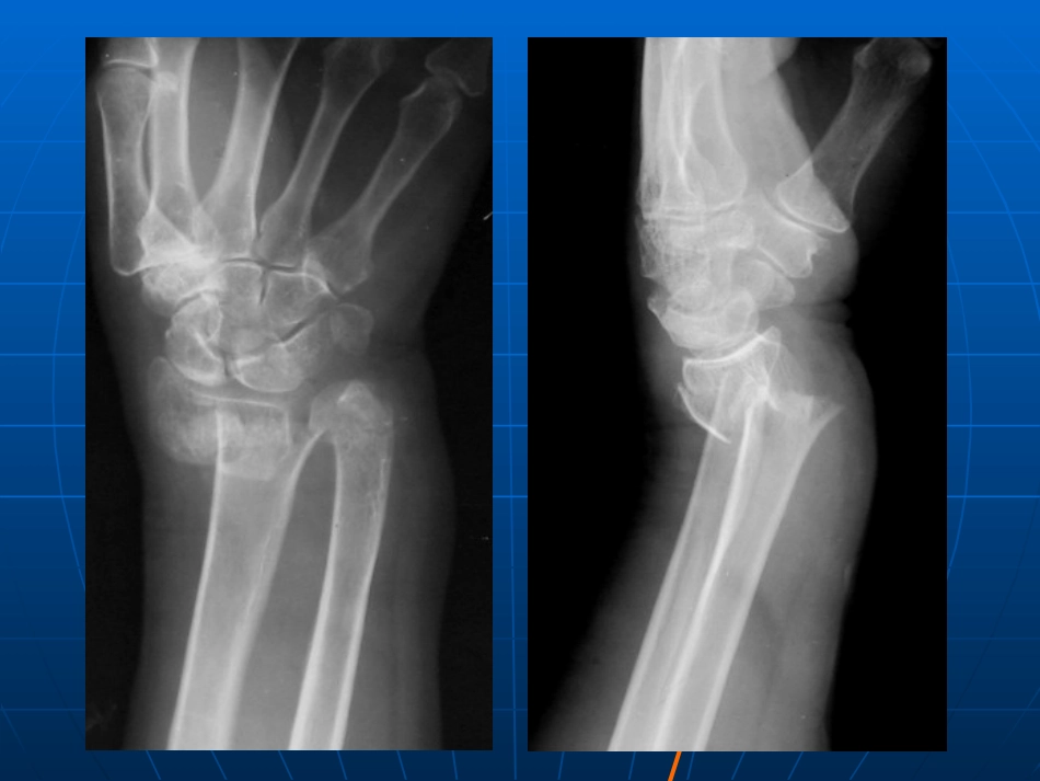 医学影像学实验报告病例_第3页