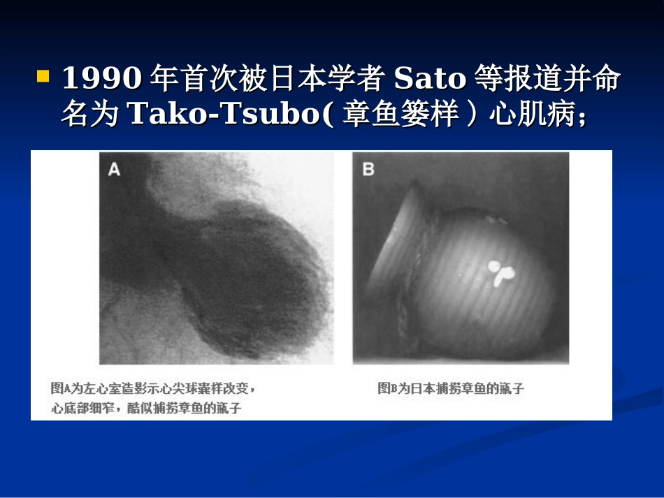 应激性心肌病_第3页