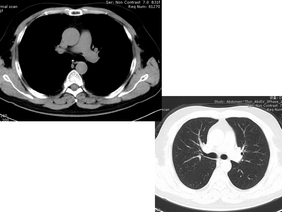 影像学考试试题_第2页