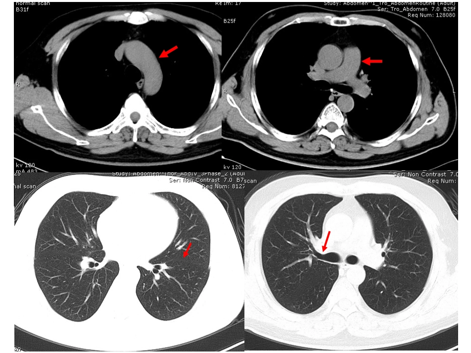 影像学考试试题_第3页