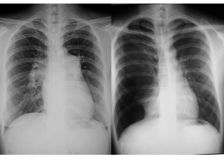 影像学考试试题