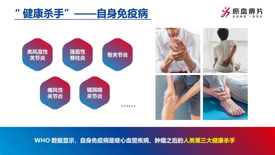 瘀血痹片风湿免疫科讲解_第2页