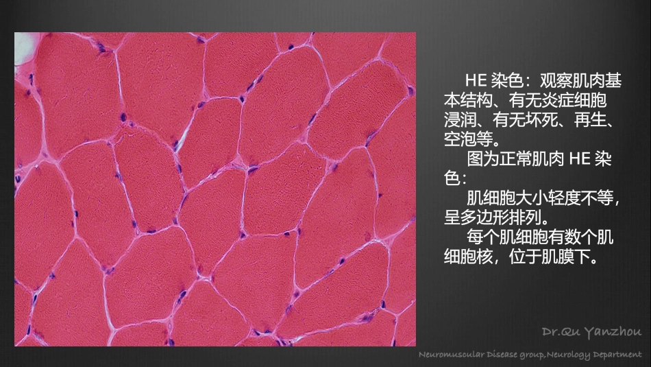 正常肌肉及常见肌病的病理学表现_第2页