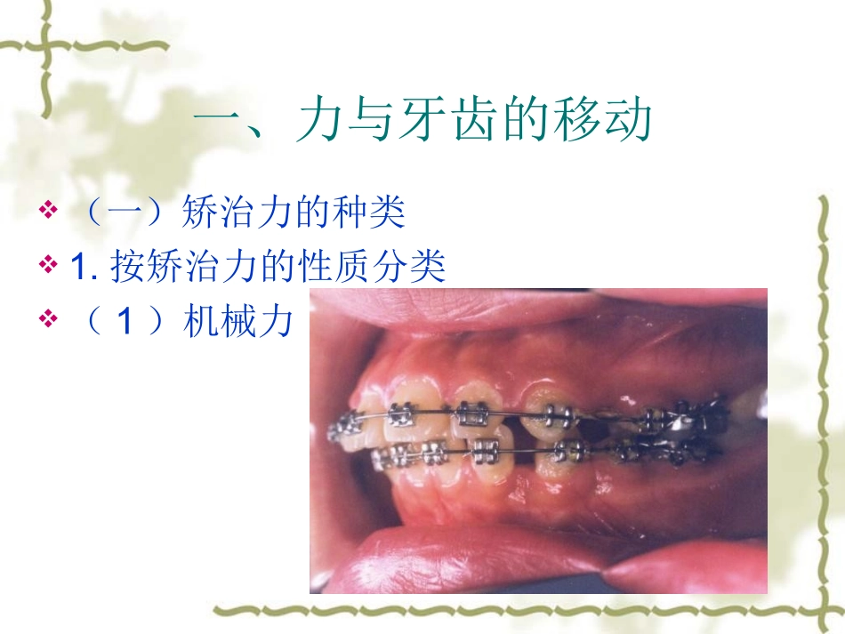 正畸治疗的生物机械原理_第2页