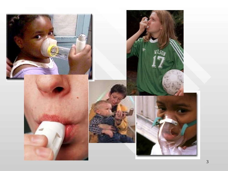 支气管哮喘短版课件_第3页