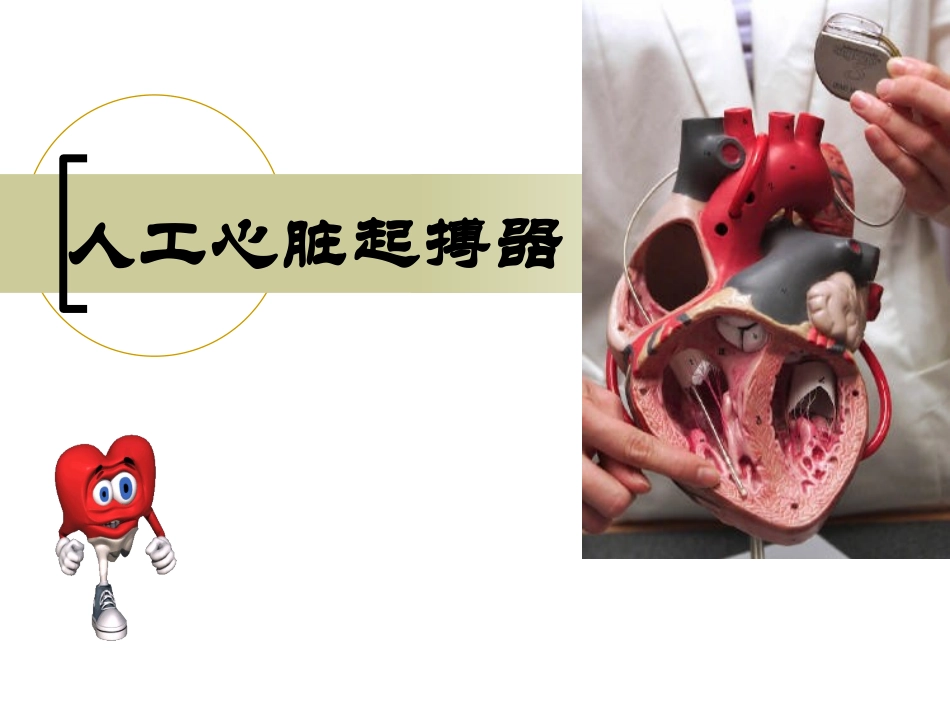 植入式心脏起搏器大全_第1页