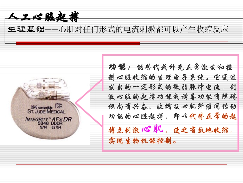 植入式心脏起搏器大全课件_第2页