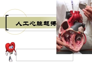 植入式心脏起搏器大全课件
