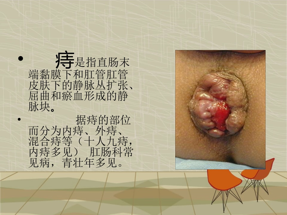 痔疮病人的护理业务查房概要_第2页