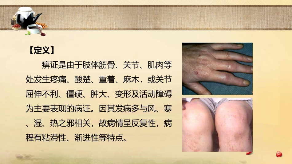 中医内科学痹证_第2页