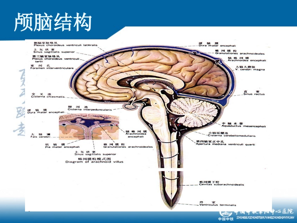 蛛网膜下腔出血的健康教育_第3页