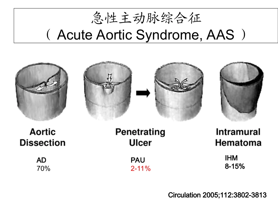 主动脉穿透溃疡的外科治疗_第3页