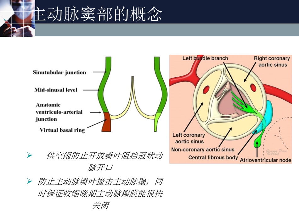 主动脉窦动脉瘤_第3页