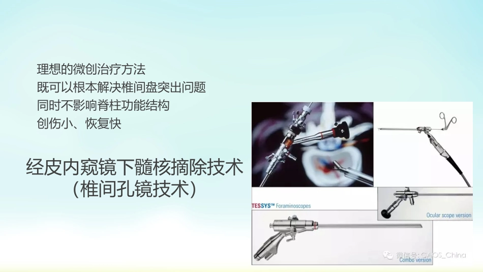 椎间孔镜技术_第3页