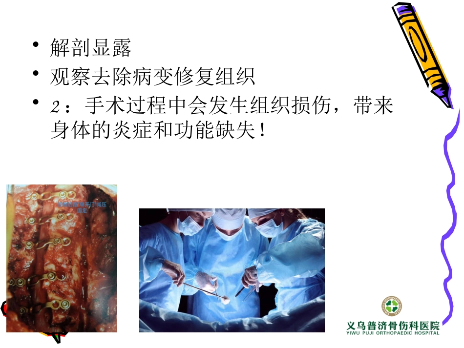 椎间孔镜治疗椎间盘突出_第3页