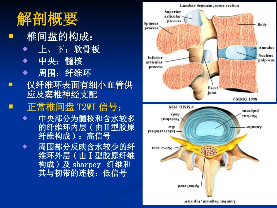 椎间盘突出影像诊疗分析_第2页