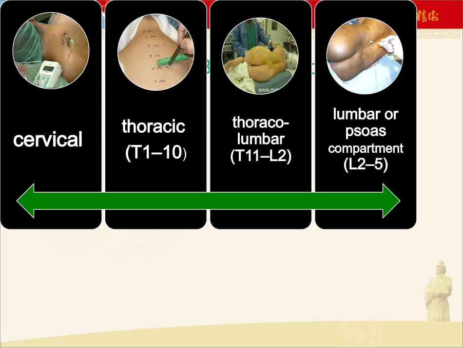 椎旁神经阻滞_第2页