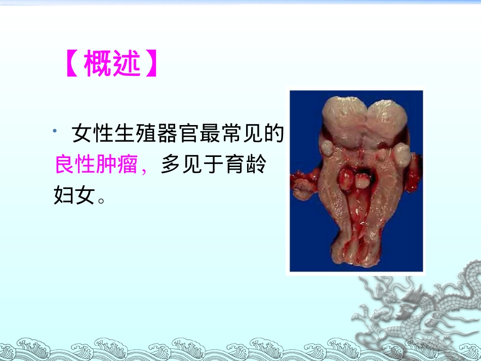 子宫肌瘤病人的术后护理_第3页