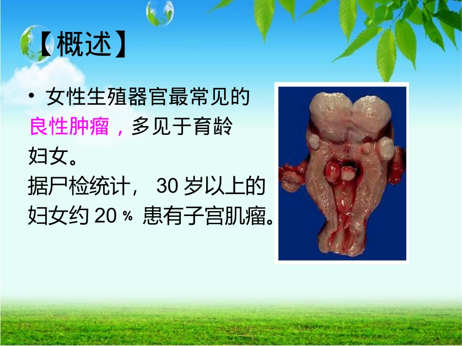 子宫肌瘤病人的术前术后护理_第3页