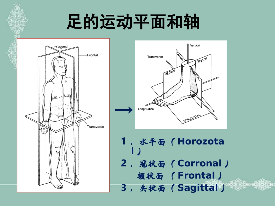 足部畸形参考课件_第3页
