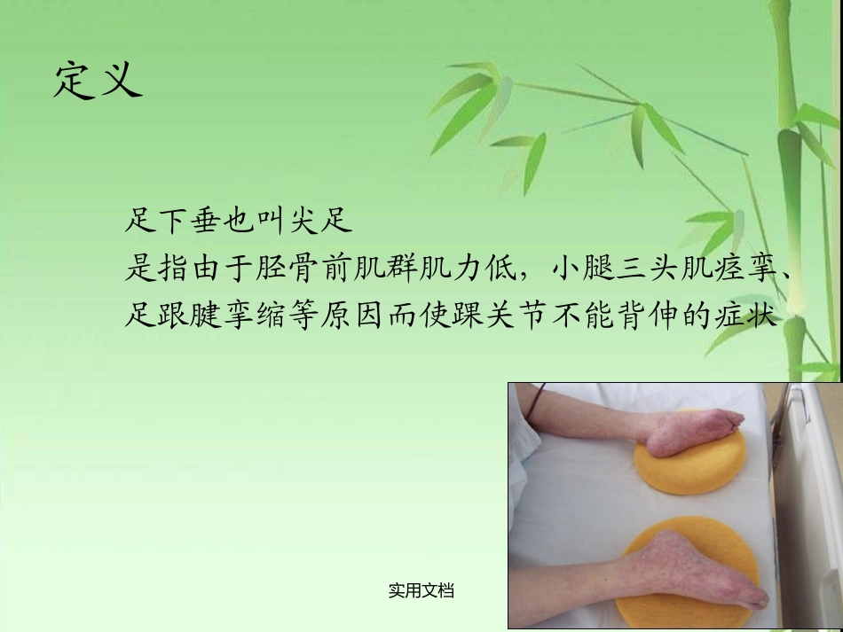 足下垂的预防及护理_第2页