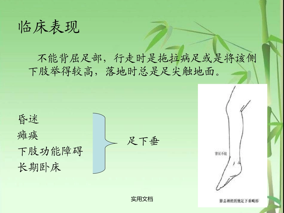 足下垂的预防及护理_第3页