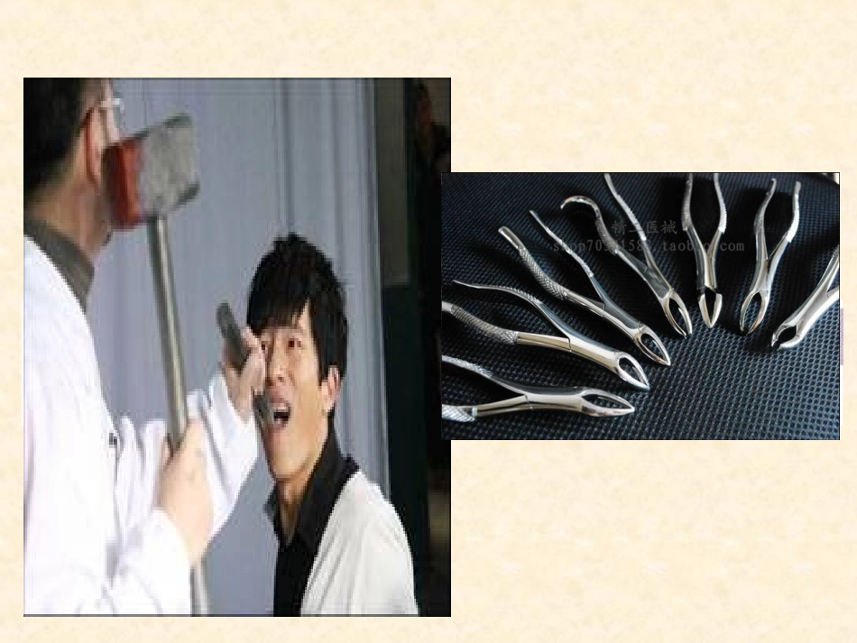 阻生牙拔除术_第3页