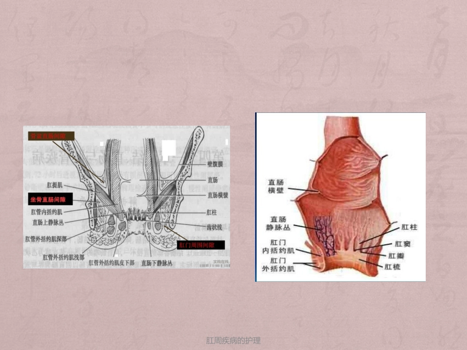 最新肛周疾病的护理_第3页