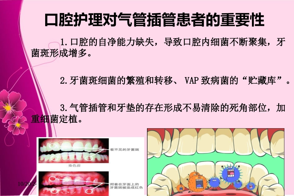 最新气管插管病人的口腔护理主题讲座课件_第3页