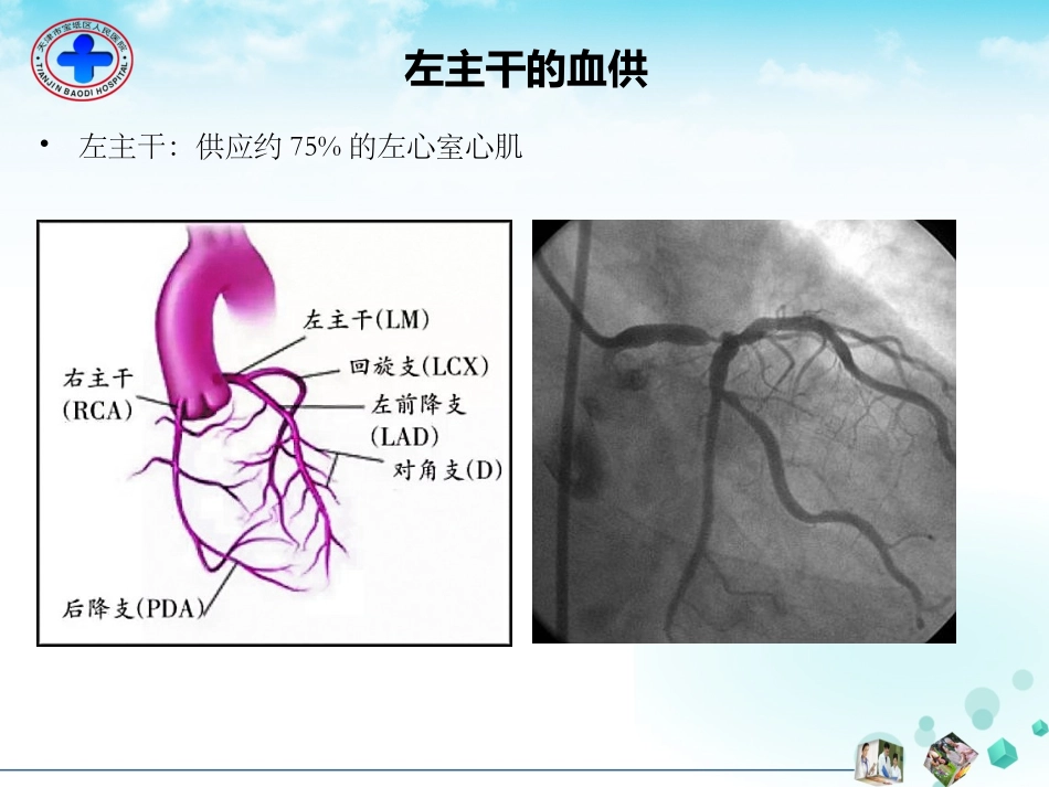 左主干闭塞的心电图表现_第2页