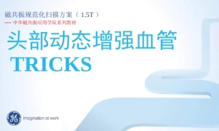 GE_1.5T_MR_头部TRICKS规范化扫描方案解析