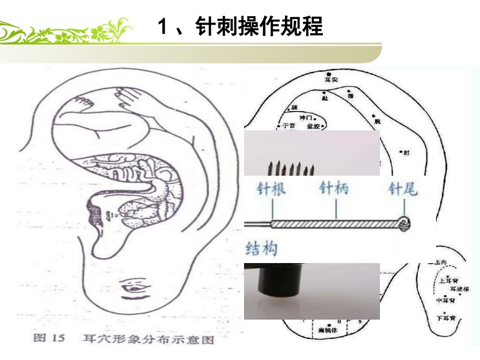 ICU中医适宜技术_第3页