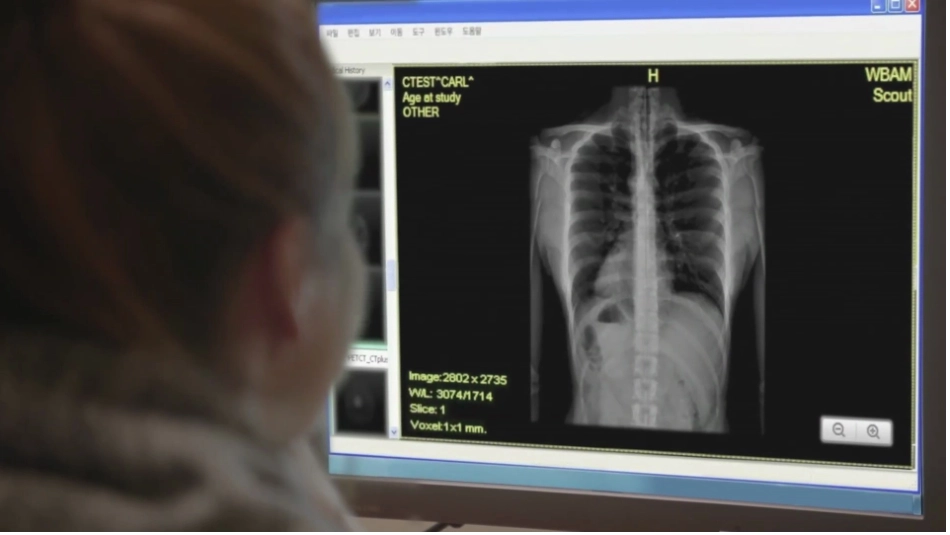 Kartagener综合征_第1页