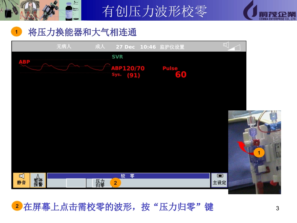 PHILIPSPiCCO模块操作说明_第3页