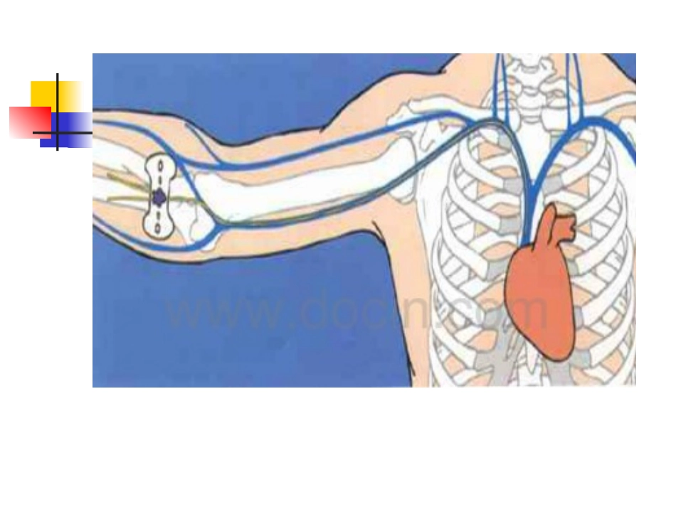 picc简介课件_第3页