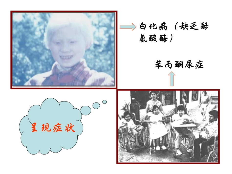 白化病缺乏酪氨酸酶_第2页