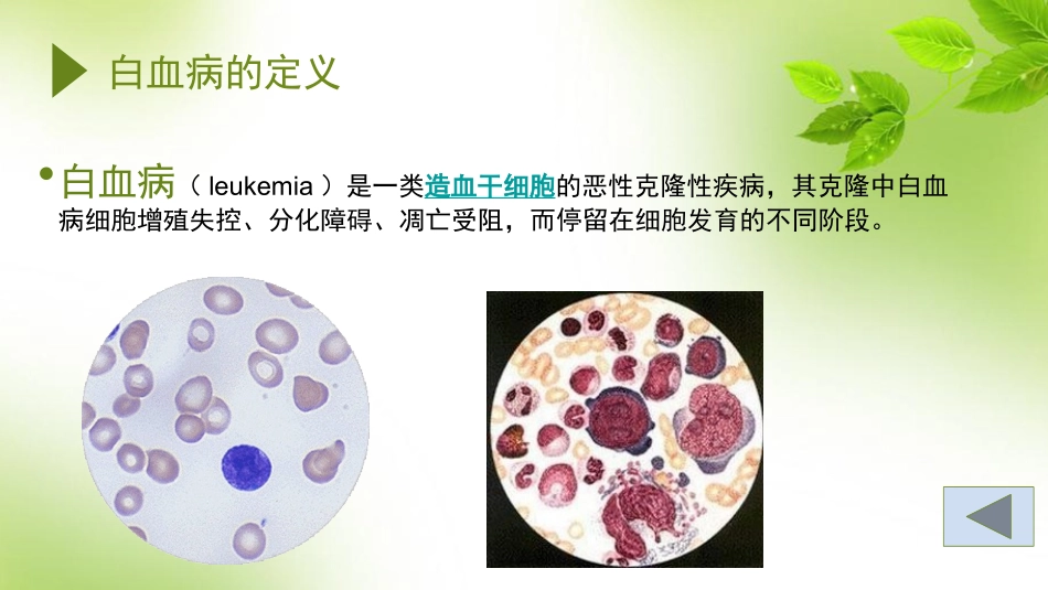 白血病的诊疗_第3页