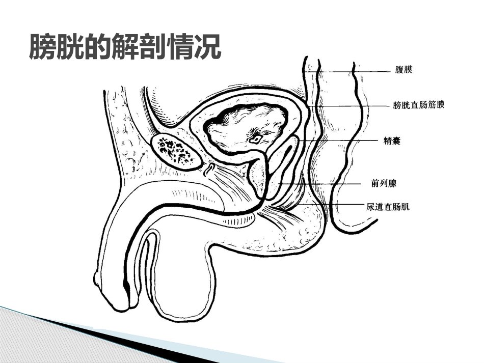 膀胱破裂导尿及造瘘_第2页