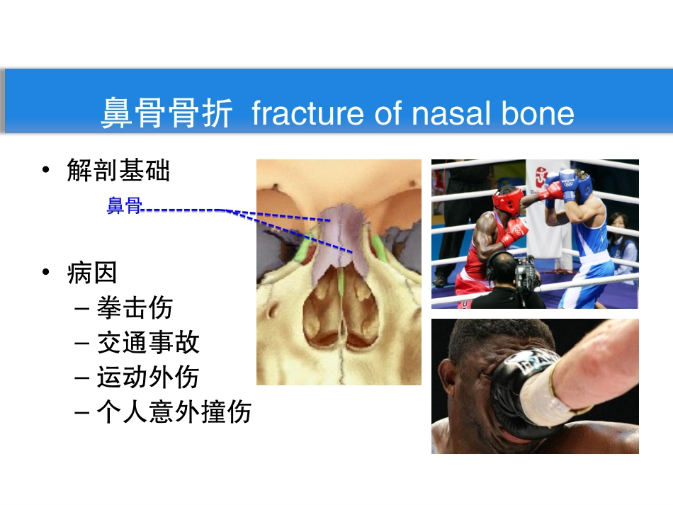 鼻外伤及鼻出血_第3页