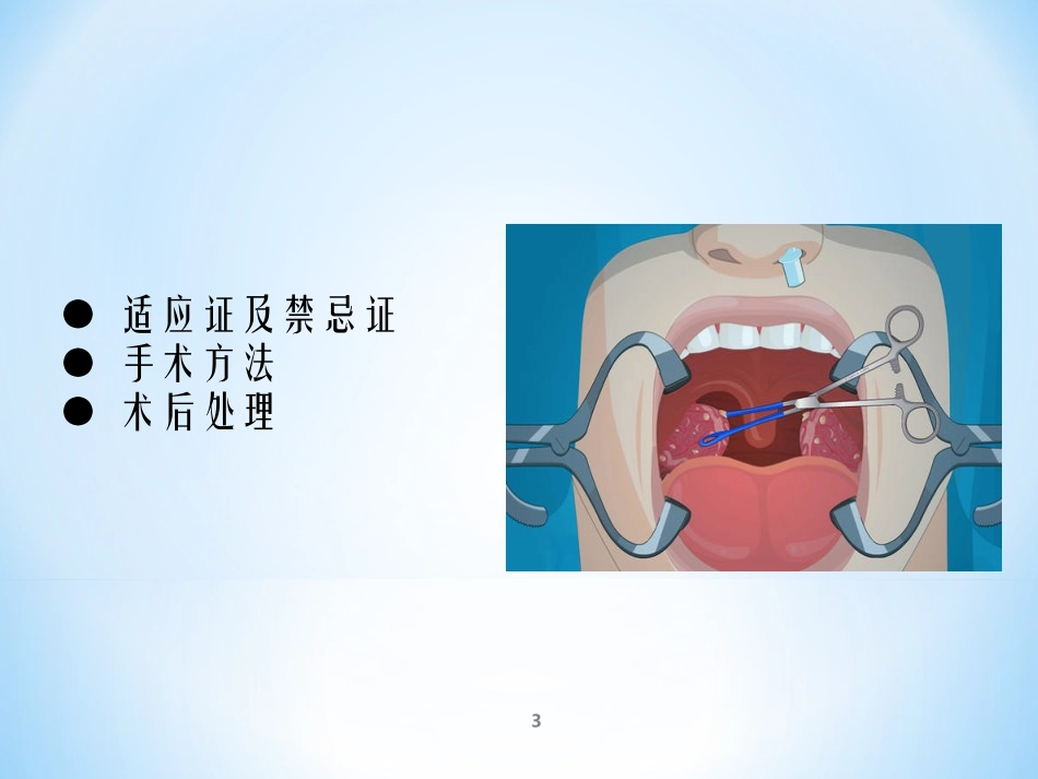扁桃体切除术课件_第3页