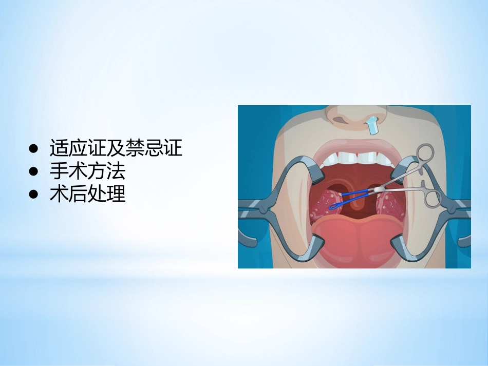 扁桃体摘除术_第3页
