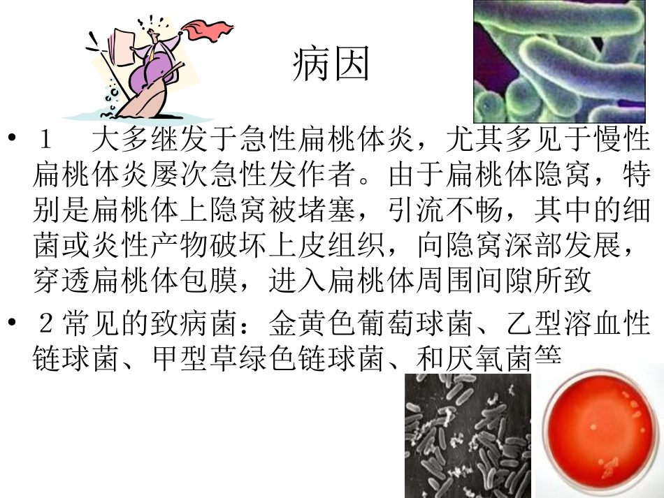 扁桃体周脓肿精_第2页