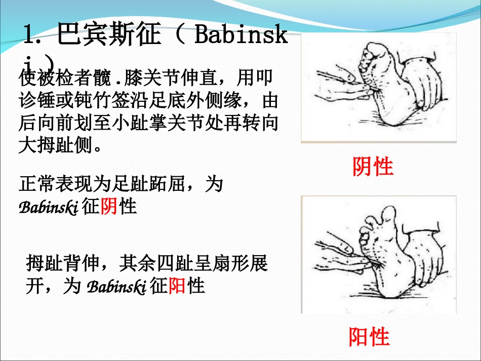 病理反射课件_第3页