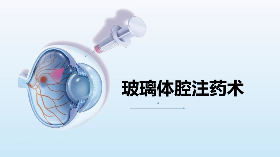 玻璃体腔注药术方法及护理_第1页