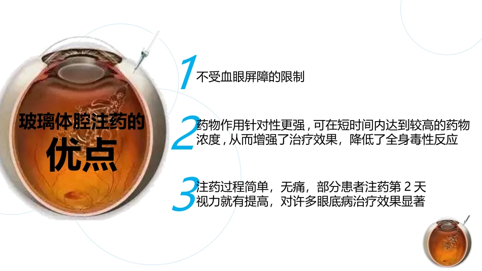 玻璃体腔注药术方法及护理_第3页