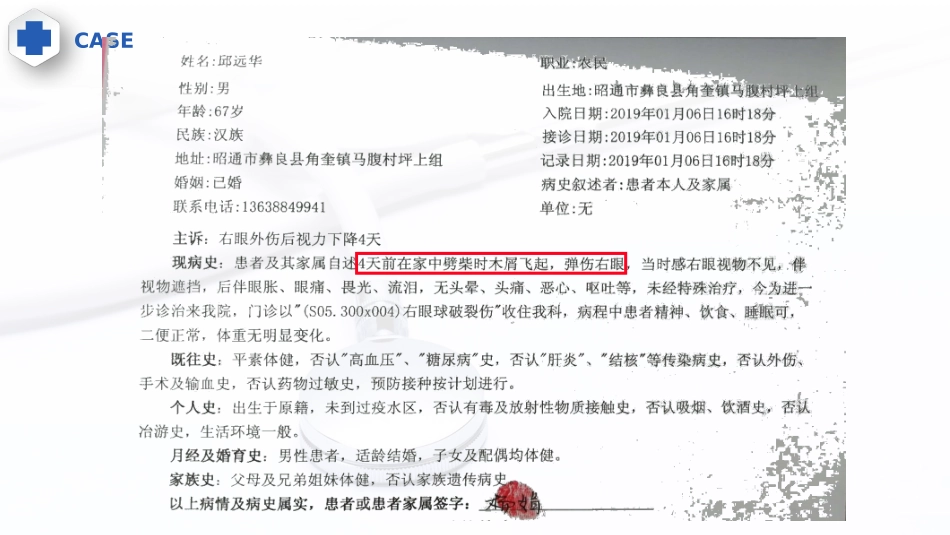 玻璃体体腔注药术IVTCJB_第3页