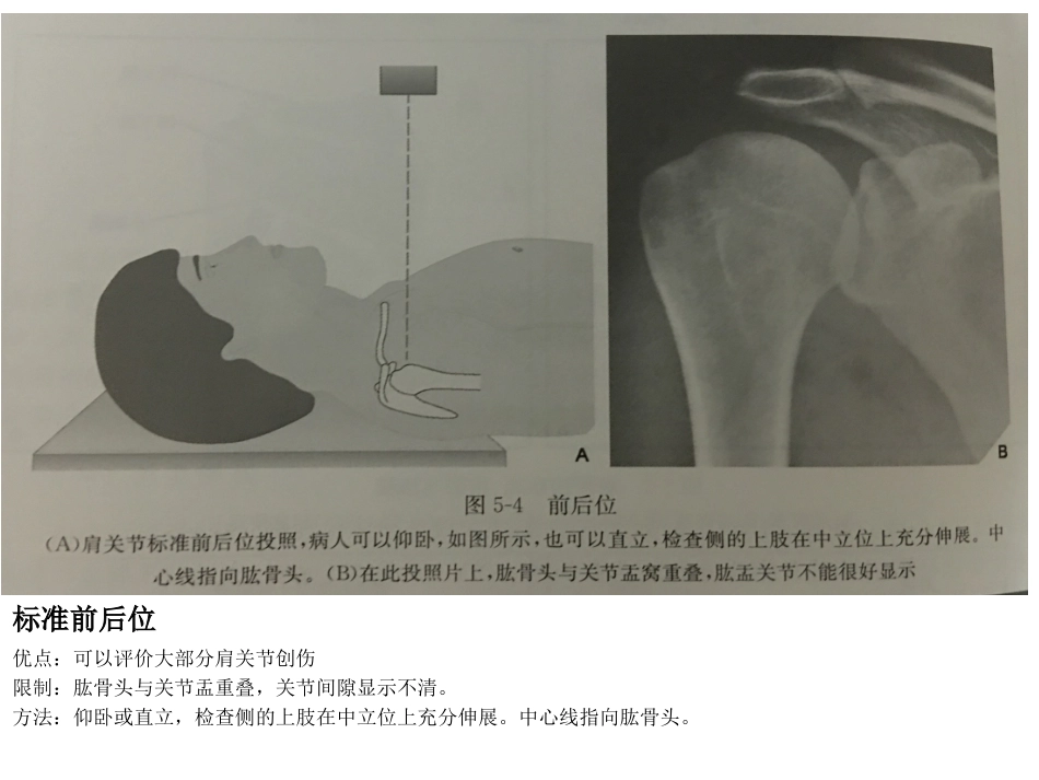 不同肩关节X线投照位_第2页