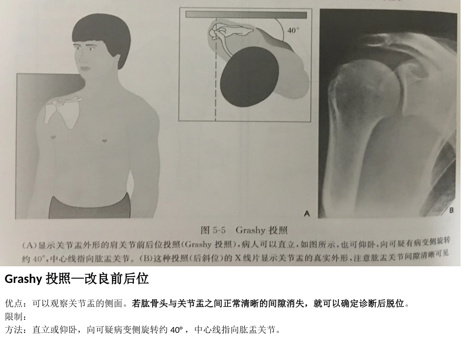 不同肩关节X线投照位_第3页
