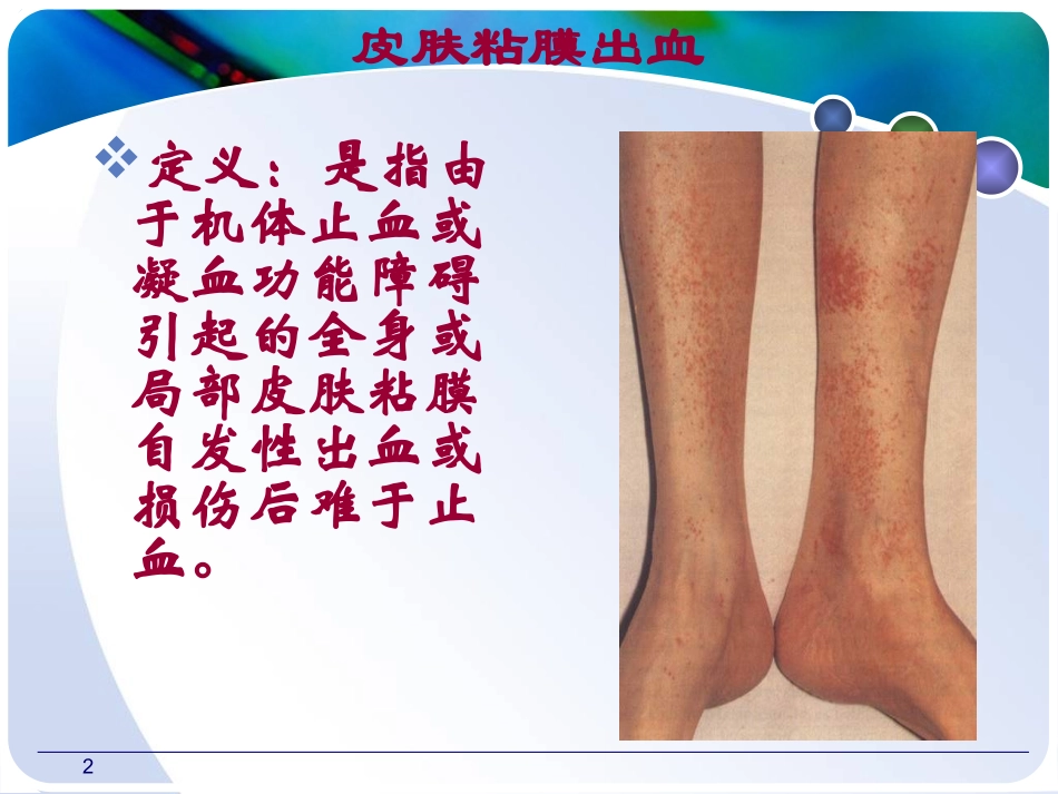常见症状皮肤粘膜出血课件_第2页