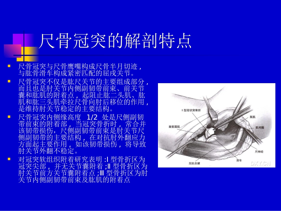 尺骨冠突骨折_第2页